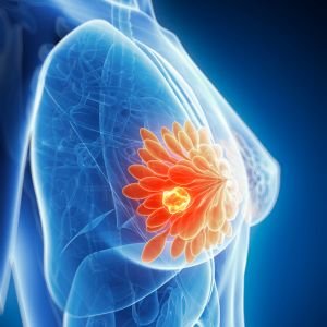 Breast Elastography