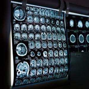 Musculoskeletal MRI
