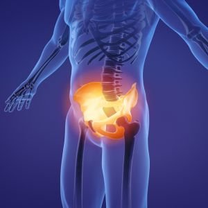 Pelvic MRI