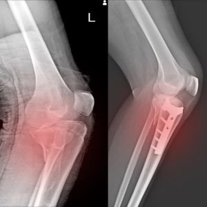 X-Ray Image